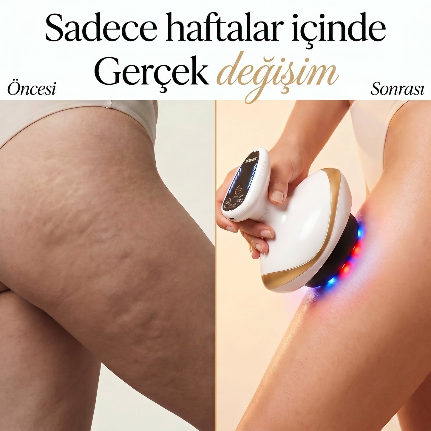 Slimfy Pro 3ü 1 Arada Masaj Aleti